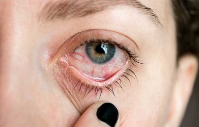 VIÊM MÀNG BỒ ĐÀO SAU CHẤN THƯƠNG - TRIỆU CHỨNG VÀ CÁCH ĐIỀU TRỊ